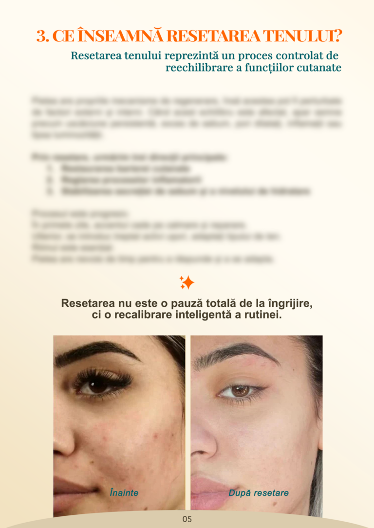 ro 05 ce înseamnă resetarea tenului